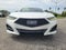 2021 Acura TLX A-SPEC Package